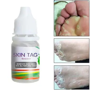 10ML Verruga Tratamento de Cravo Mortas da Pele Corporal Tratamento de Verrugas da Pele do Creme de Remoção de Plantar Warts Genital Pomada Tag Pele do Pé