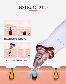 Microdermabrasion Removedor De Cravo De Sucção A Vácuo Cara De Espinha De Acne Comedone Extrator Os Poros Faciais Limpeza De Pele Ferramentas De Cuidados