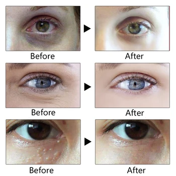 VIBRANTE GLAMOUR de Proteínas do Soro de Caracol Creme para os Olhos Anti-Envelhecimento Removedor de Rugas e olheiras Contra o Inchaço Levantamento de Endurecimento do Olho Cuidados